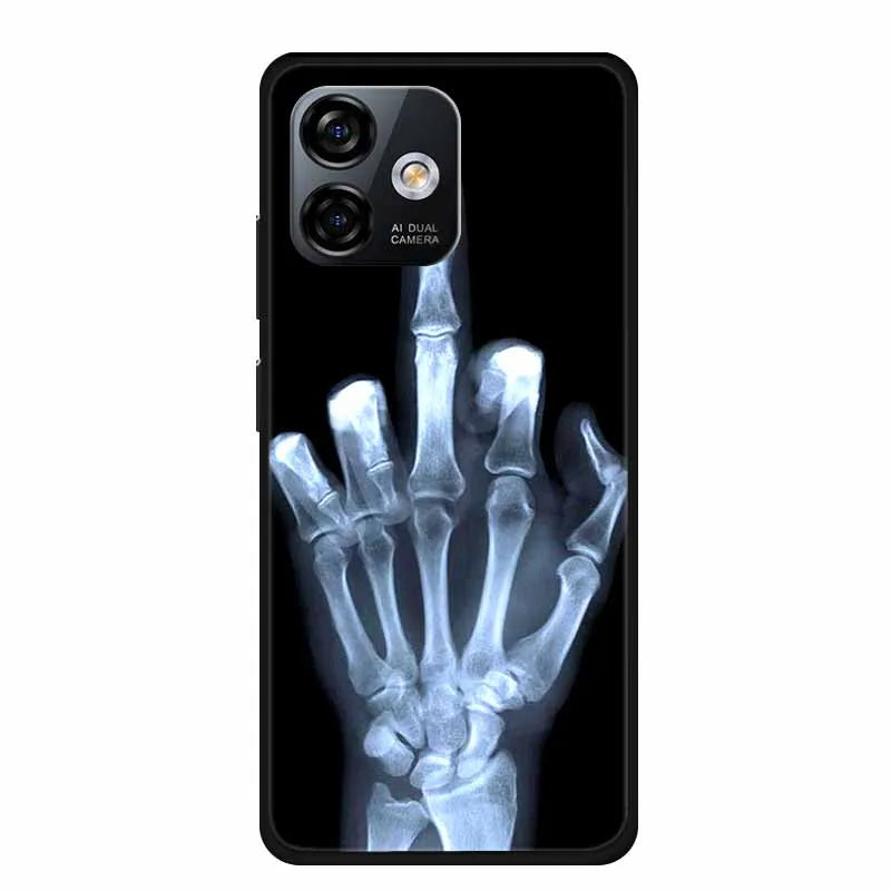 Coque Silicone Ulefone Note 16 Pro – 60 Couleurs, Ultra Fine, Anti-Chocs